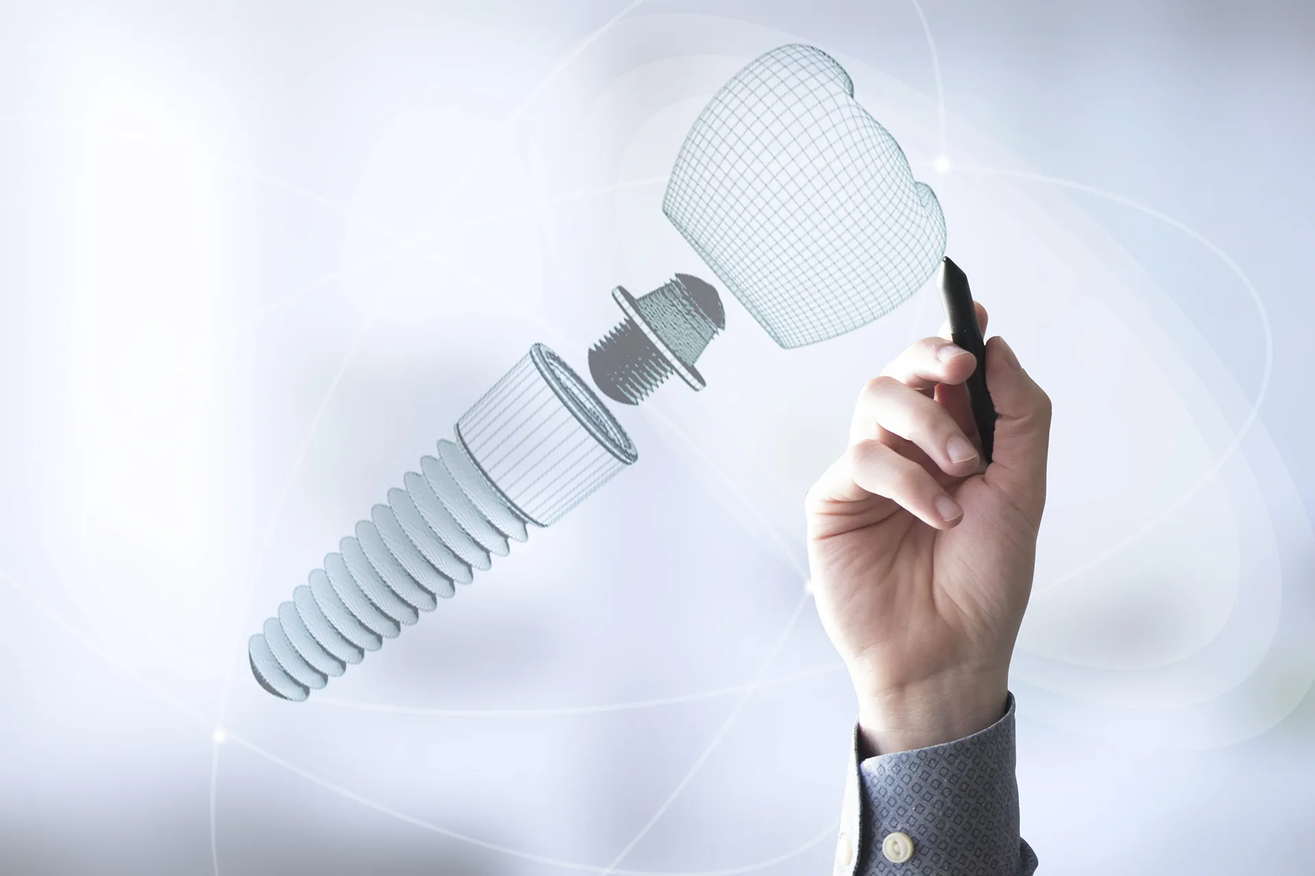 Implantes Dentales en Alcalá de Guadaíra  Sevilla Clínica Dental López Lora